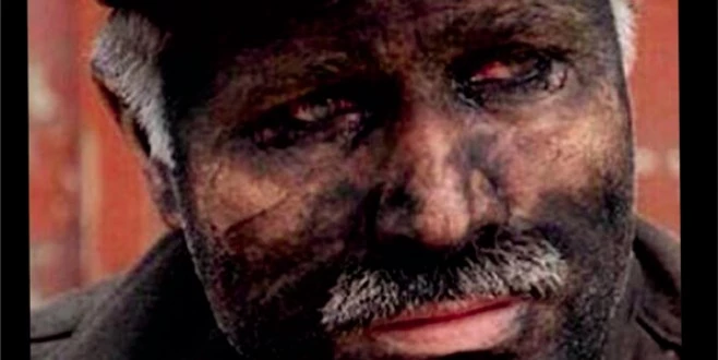 GÜRKAN, “ACIMIZ ÇOK BÜYÜK;SOMA YÜREĞİMİZİ YAKTI!”